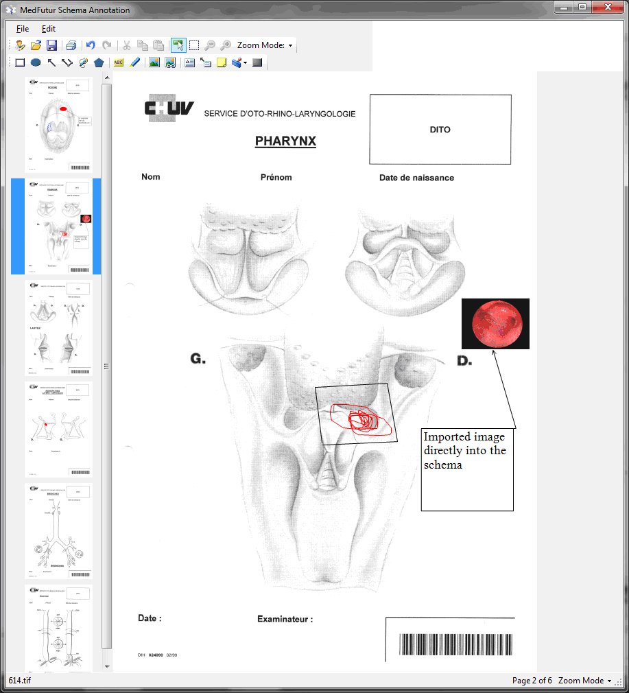 medfutur_screenshot_schema_3.png